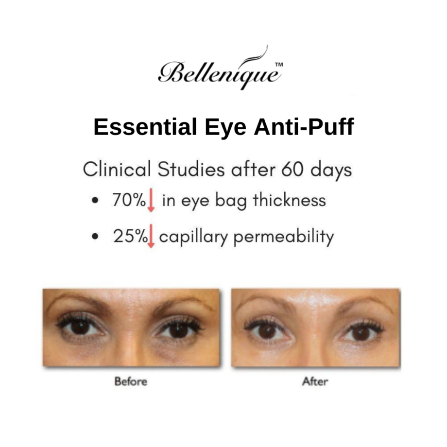 https://avli.sg/wp-content/uploads/2022/06/Bellenique-Essential-Eye-Anti-puff-5-Clinical-Study.png
