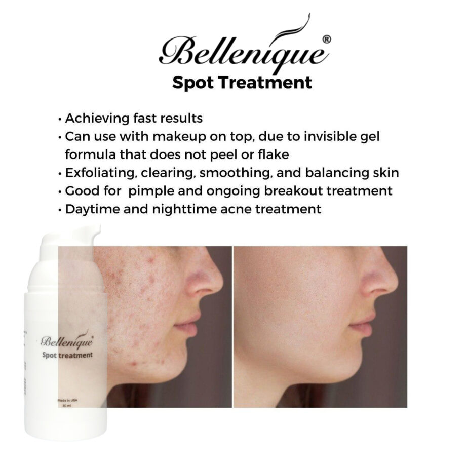 https://avli.sg/wp-content/uploads/2022/06/Bellenique-Spot-Treatment-3.jpg